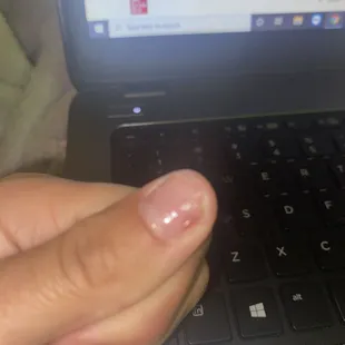 Rips nail off