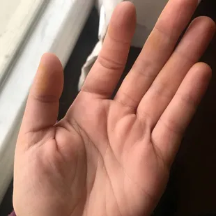 Washed my hand 3 times and my thumb and fingers have been stained by something I just ate