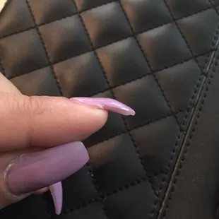 Horrible shape