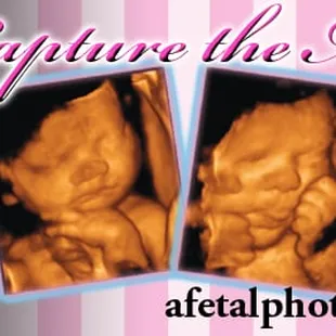 Capture the Moments You will Cherish Forever