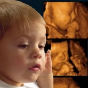 Capture the Moments You will Cherish Forever