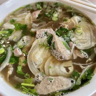 Pho Dac Biet
