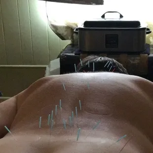 Back Treatment.