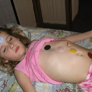 Young Patient during balancing session.