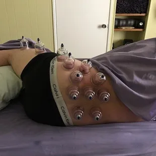 The healing power of cups!