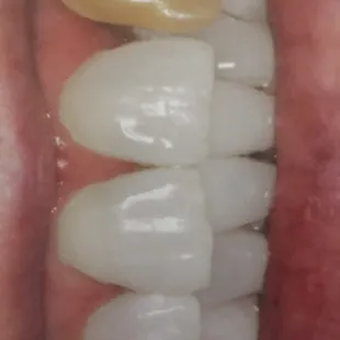 Lincoln Dental Plans