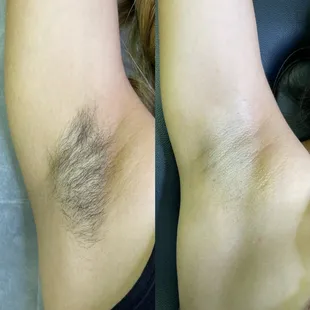 Underarm wax