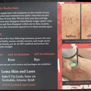 Spider vein specials