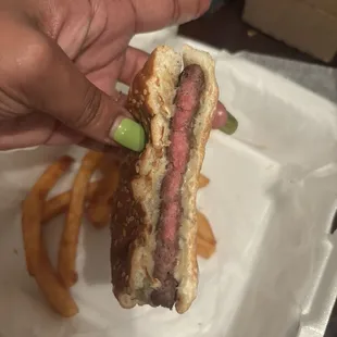 Second undercooked burger