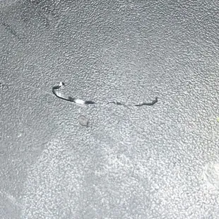 Metal Piece In The Fried Shrimp