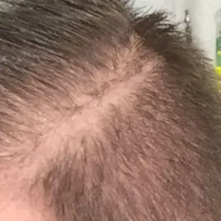 They cut a line about a half inch away from my disconnect. Guy didn't even change the razor after the last cut.