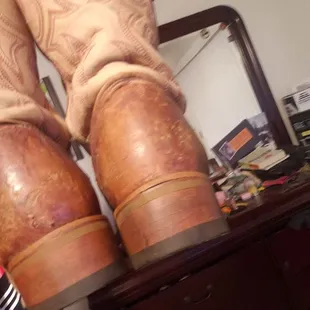 New heels and a patch job