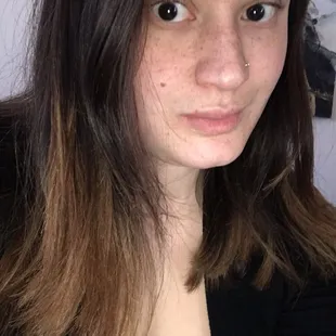 Clear skin after years of struggling! Thank you Lisa!