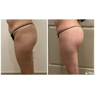 Physiq glute membership toning muscle and contouring body