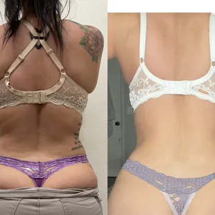 Body sculpting ONE session