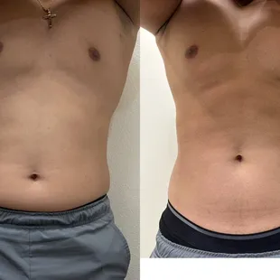 ONE session RESULT! Body sculpting