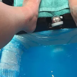 My friends feet are so red from being burned