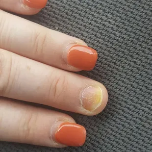Thanks for the nail infection. Don&apos;t go here!