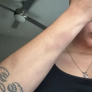 More bruises from security