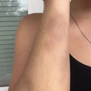 These bruises have been throbbing for 2 days now
