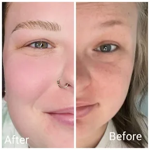 Microblading