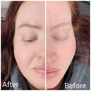 Microblading before and after