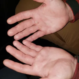 two open hands