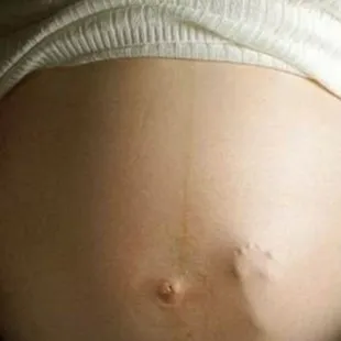 Pregnancy Massage Available post 1st Trimester &amp; permission from MD