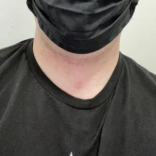 Ricochet impact to my throat at marksman pistol range in Tucson, Az on 28 March 2021