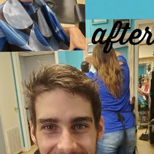 Before and after for this young man