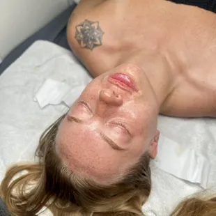 Post Hydrafacial Glow