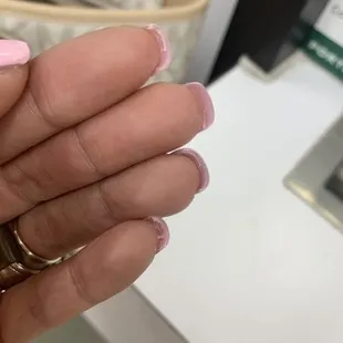 Why is there acrylic even there??!