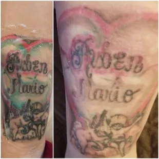 Dr.Mayberry and staff made me feel very comfortable. Shocked by the results in just one session.Looking forward to the end results.