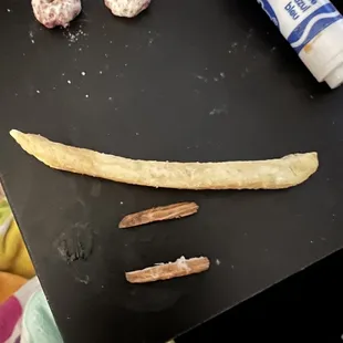 Wood chips that were inside my son's French fry