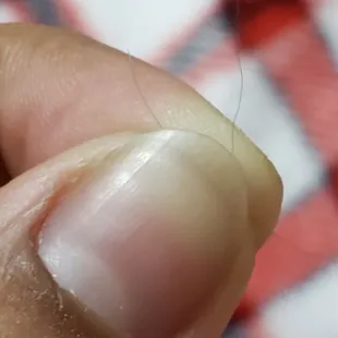 a person's finger with a needle in it