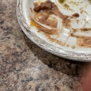 Pube or hair or whatever in my food.