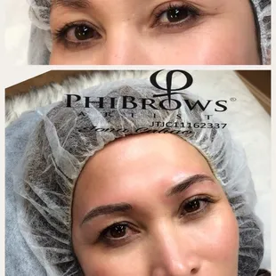 #beforeandafter