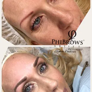 Eyebrows revision first appointment
