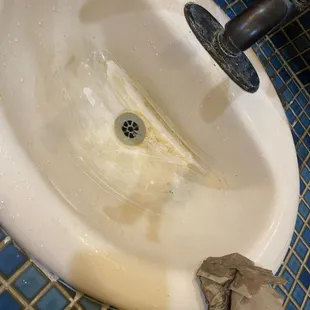 A worker said it was stained, so I got a towel and scrapped it to show her (she knew full well) that it's FILTH