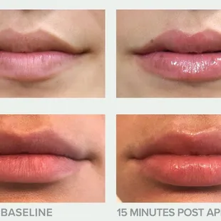 Achieve this daily with our Lip Treatment Serum SPF30