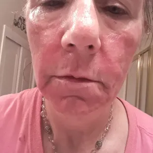 Do you want to go thru this?