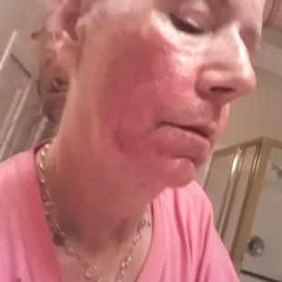 Help! Wedding in 8 days.  Doctor said " there is always Photoshop.