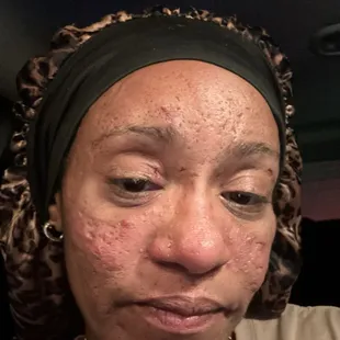 After I got assaulted