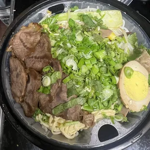 Love that the noodles, proteins, and veggies are in a separate tray above the broth!