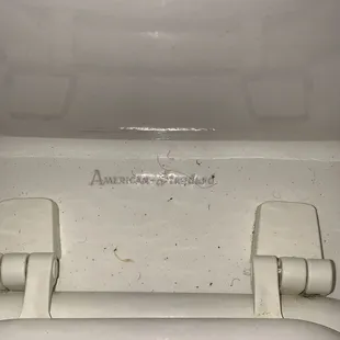 Dirt on toilet,hair also present