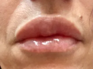 Mayberry Plastic Surgery