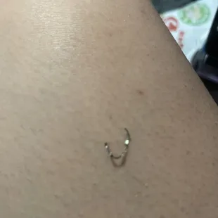 This was in my fried rice. Please be careful if you do eat here