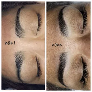 Brow transformation
