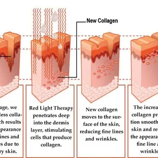 MyTime Red Light Therapy