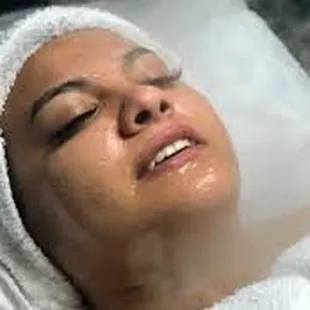 Hydration facial treatment